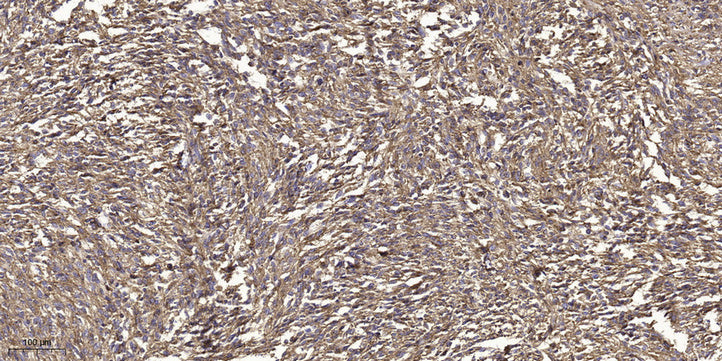 GRK2 (Phospho-Tyr86) Rabbit Polyclonal Antibody