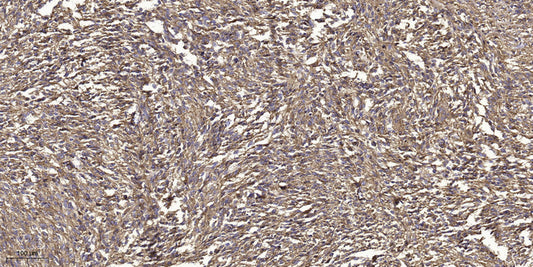 GRK2 (Phospho-Tyr86) Rabbit Polyclonal Antibody