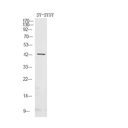 Gz-α (Phospho-Ser16) Rabbit Polyclonal Antibody