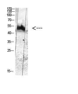 MDM2 (Phospho-Tyr394) Rabbit Polyclonal Antibody