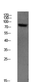 SYK (Phospho-Tyr348) Rabbit Polyclonal Antibody