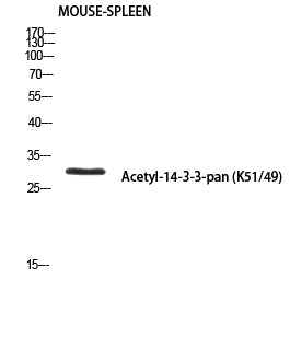 14-3-3-pan (Acetyl Lys51/49) Rabbit Polyclonal Antibody