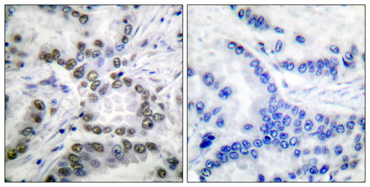 CBP (Acetyl Lys1535) Rabbit Polyclonal Antibody