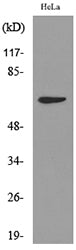 Cytokeratin-pan (Acetyl Lys194) Rabbit Polyclonal Antibody