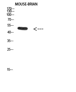 E2F-1 (Acetyl-Lys120) Rabbit Polyclonal Antibody
