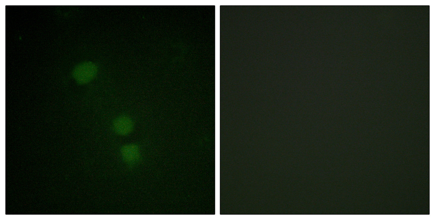 Histone H2B (Acetyl Lys15) Rabbit Polyclonal Antibody
