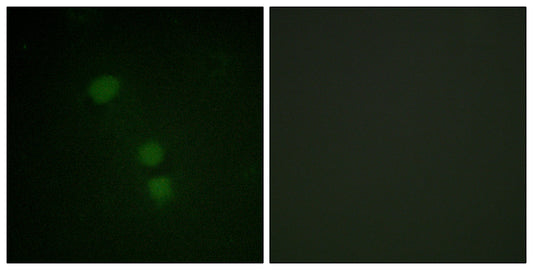 Histone H2B (Acetyl Lys15) Rabbit Polyclonal Antibody