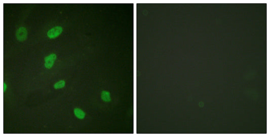 Histone H2B (Acetyl Lys5) Rabbit Polyclonal Antibody