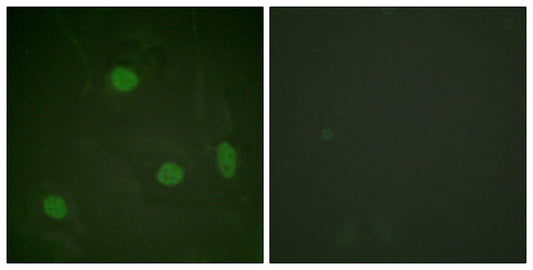 Histone H3 (Acetyl Lys23) Rabbit Polyclonal Antibody