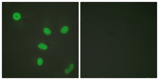 Histone H3 (Acetyl Lys27) Rabbit Polyclonal Antibody