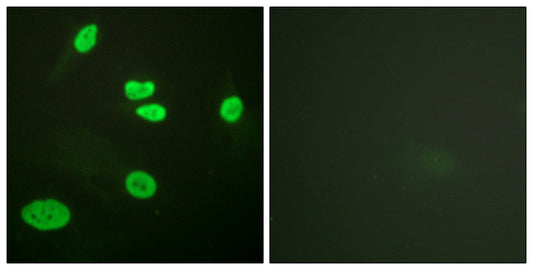 Histone H3 (Acetyl Lys9) Rabbit Polyclonal Antibody