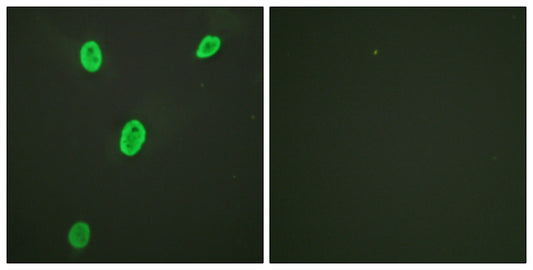 Histone H4 (Acetyl Lys12) Rabbit Polyclonal Antibody