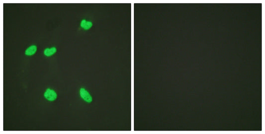 Histone H4 (Acetyl Lys16) Rabbit Polyclonal Antibody