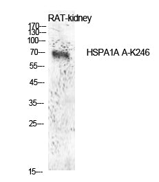 HSP70 (Acetyl Lys246) Rabbit Polyclonal Antibody