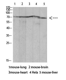 Ku-70 (Acetyl Lys317) Rabbit Polyclonal Antibody