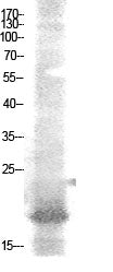 NF-E4 (Acetyl Lys43) Rabbit Polyclonal Antibody