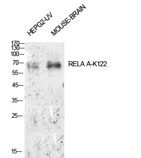 NFκB-p65 (Acetyl Lys122) Rabbit Polyclonal Antibody