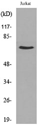 NFκB-p65 (Acetyl Lys218) Rabbit Polyclonal Antibody
