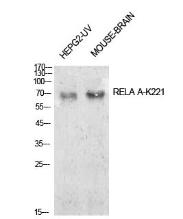 NFκB-p65 (Acetyl Lys221) Rabbit Polyclonal Antibody