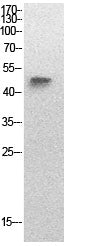p53 (Acetyl Lys320) Rabbit Polyclonal Antibody