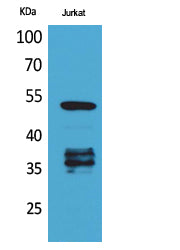 p53 (Acetyl Lys370) Rabbit Polyclonal Antibody