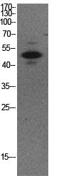 p53 (Acetyl Lys373) Rabbit Polyclonal Antibody