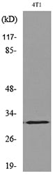 p57 (Acetyl Lys278) Rabbit Polyclonal Antibody