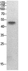 PTEN (Acetyl Lys402) Rabbit Polyclonal Antibody