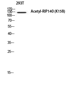 RIP140 (Acetyl Lys158) Rabbit Polyclonal Antibody