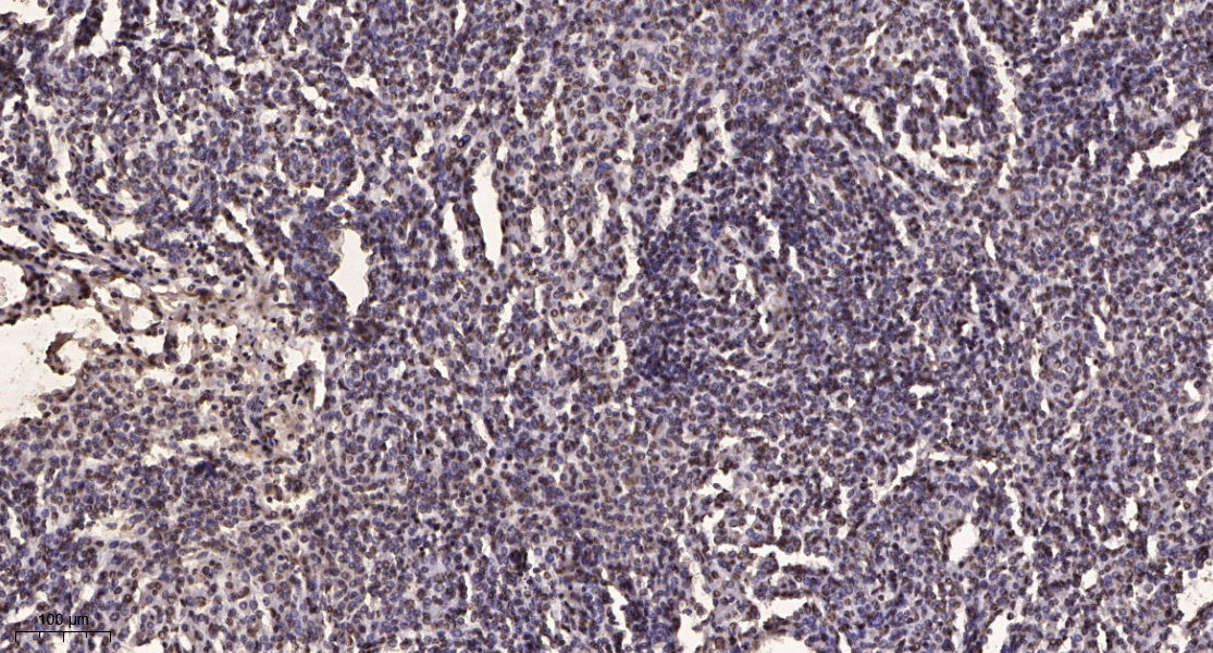 Smad2/3 (Acetyl-Lys19) Rabbit Polyclonal Antibody