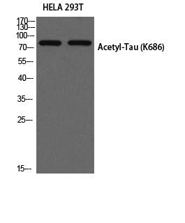 Tau (Acetyl Lys686) Rabbit Polyclonal Antibody