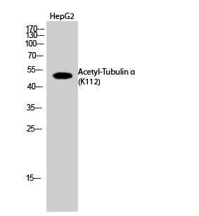 Tubulin α (Acetyl Lys112) Rabbit Polyclonal Antibody