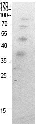 Ub (Acetyl Lys27) Rabbit Polyclonal Antibody