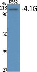 4.1G Rabbit Polyclonal Antibody