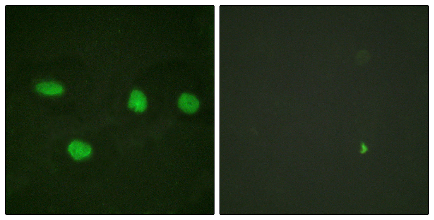 53BP1 Rabbit Polyclonal Antibody