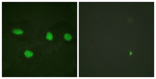 53BP1 Rabbit Polyclonal Antibody