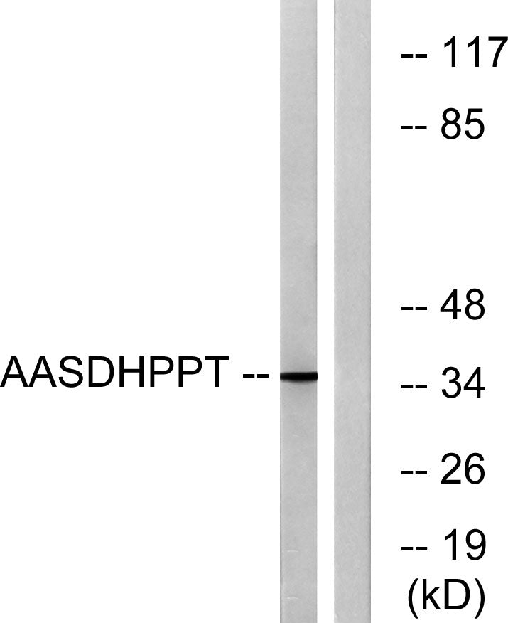 AASD-PPT Rabbit Polyclonal Antibody