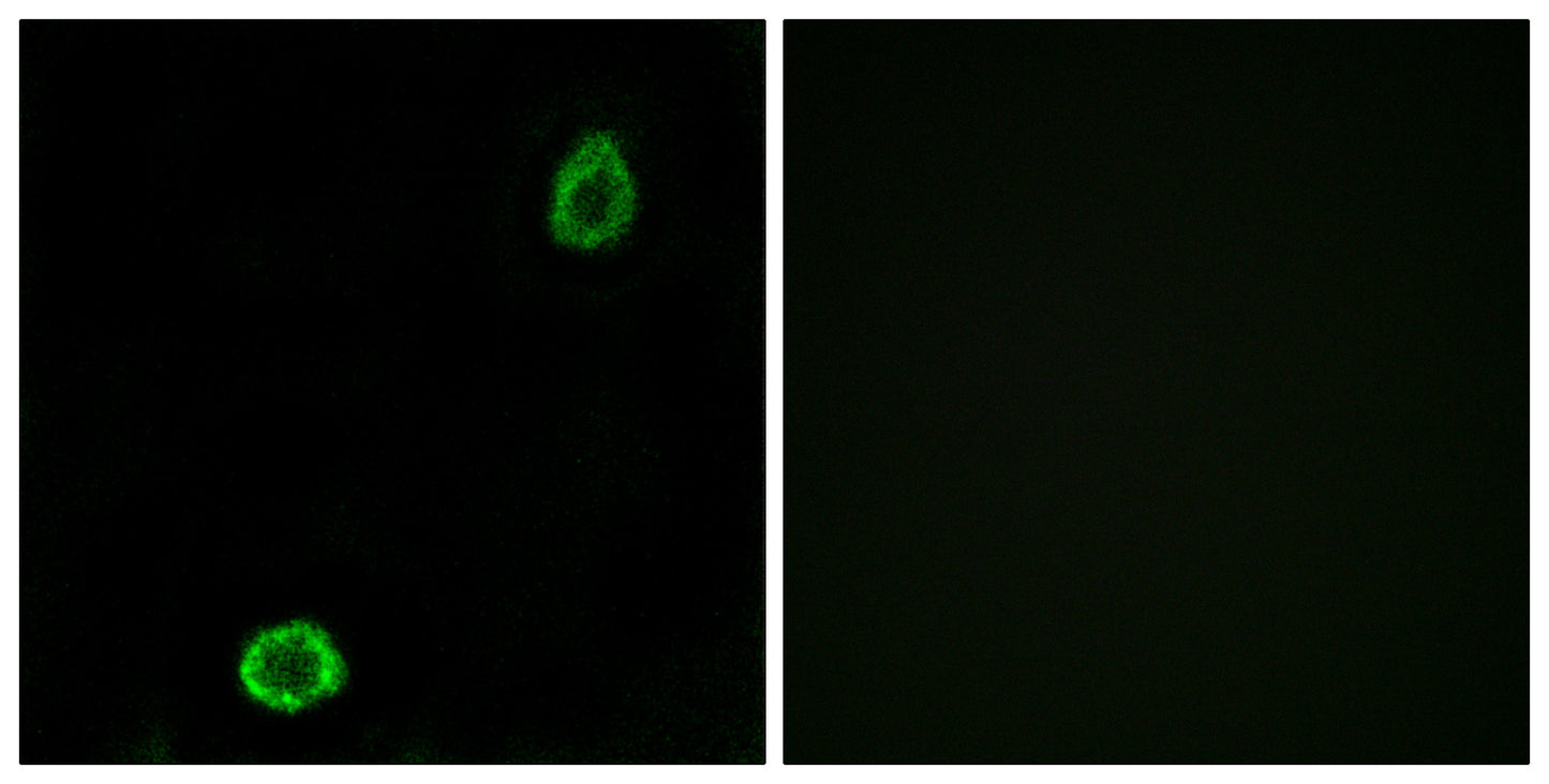 ABCA13 Rabbit Polyclonal Antibody