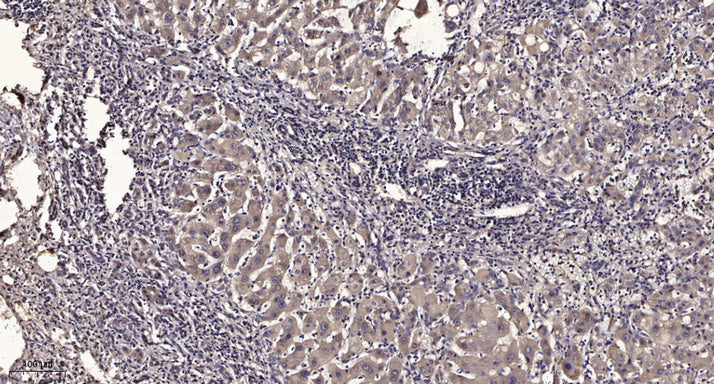 ABCAC Rabbit Polyclonal Antibody