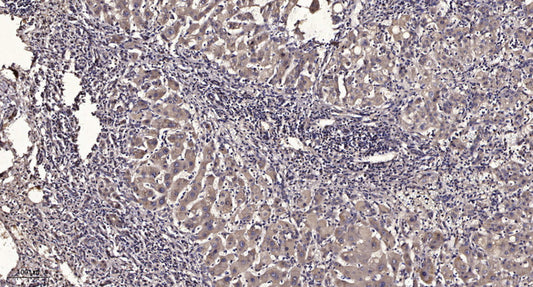 ABCAC Rabbit Polyclonal Antibody