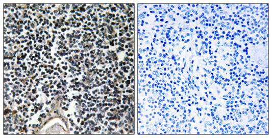 ABCB7 Rabbit Polyclonal Antibody