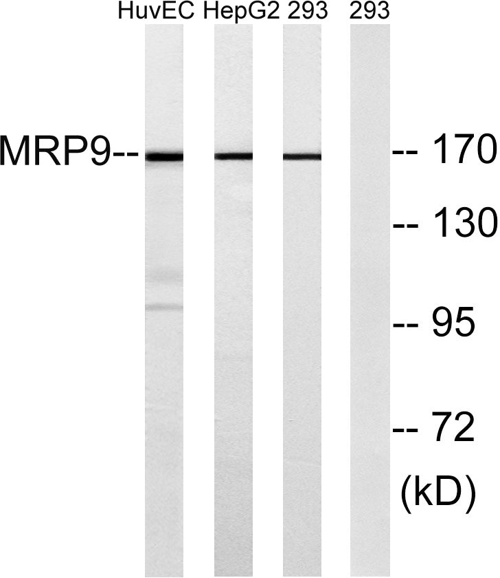 ABCC12 Rabbit Polyclonal Antibody