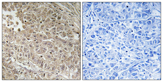ABCC13 Rabbit Polyclonal Antibody