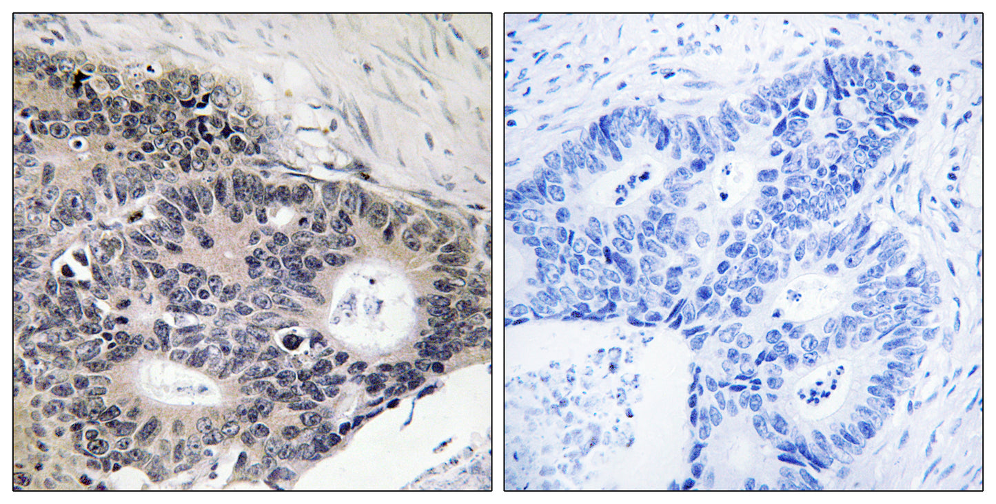 ABHD12B Rabbit Polyclonal Antibody