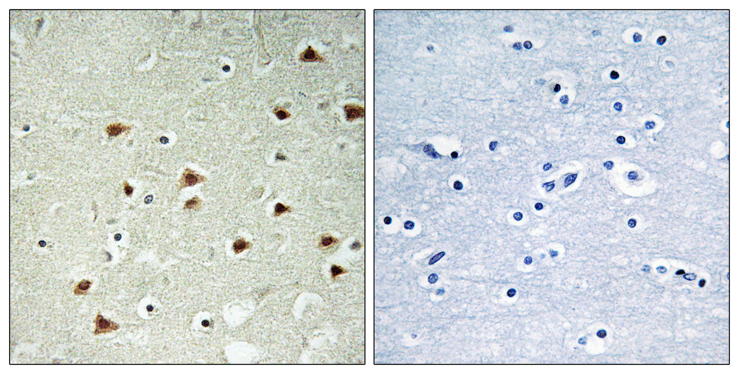 ABHD14B Rabbit Polyclonal Antibody