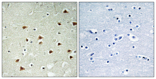 ABHD14B Rabbit Polyclonal Antibody
