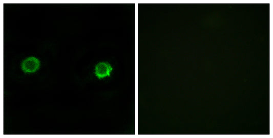 ABHD2 Rabbit Polyclonal Antibody