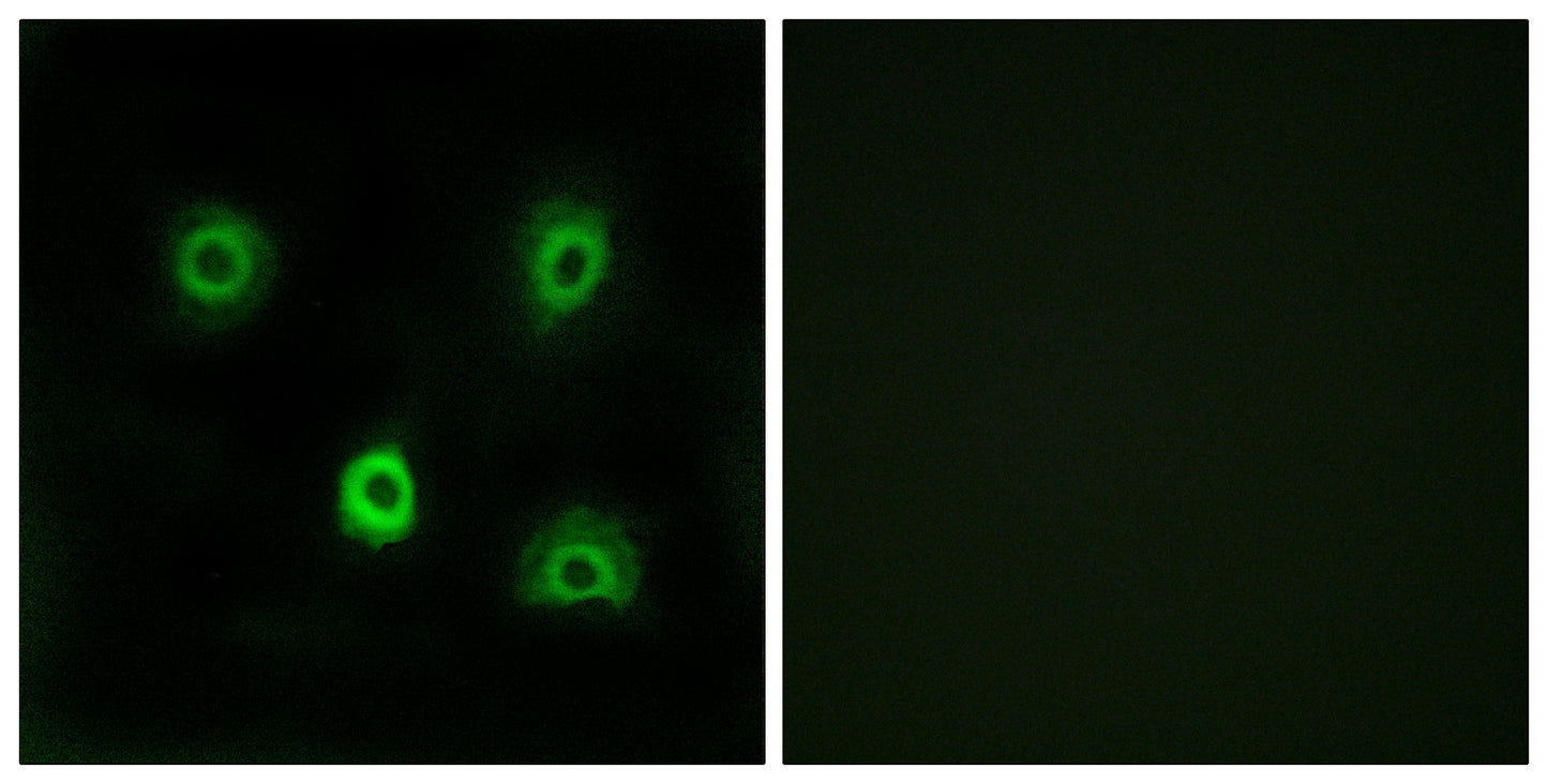 ABHD6 Rabbit Polyclonal Antibody