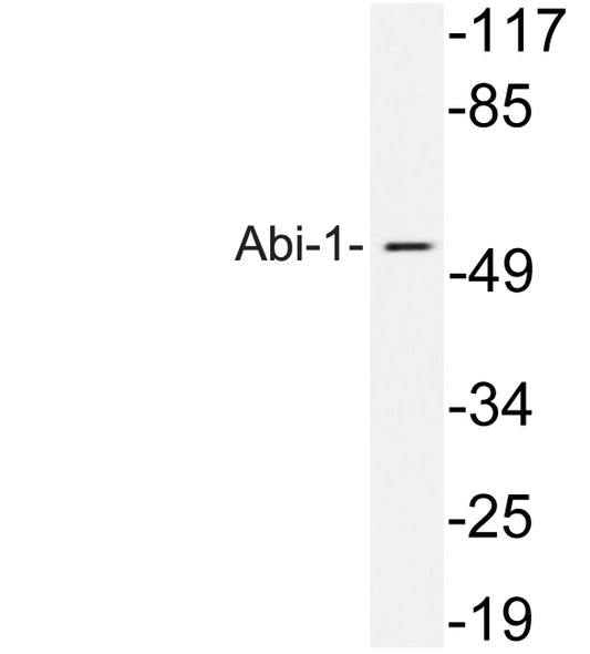 Abi-1 Rabbit Polyclonal Antibody