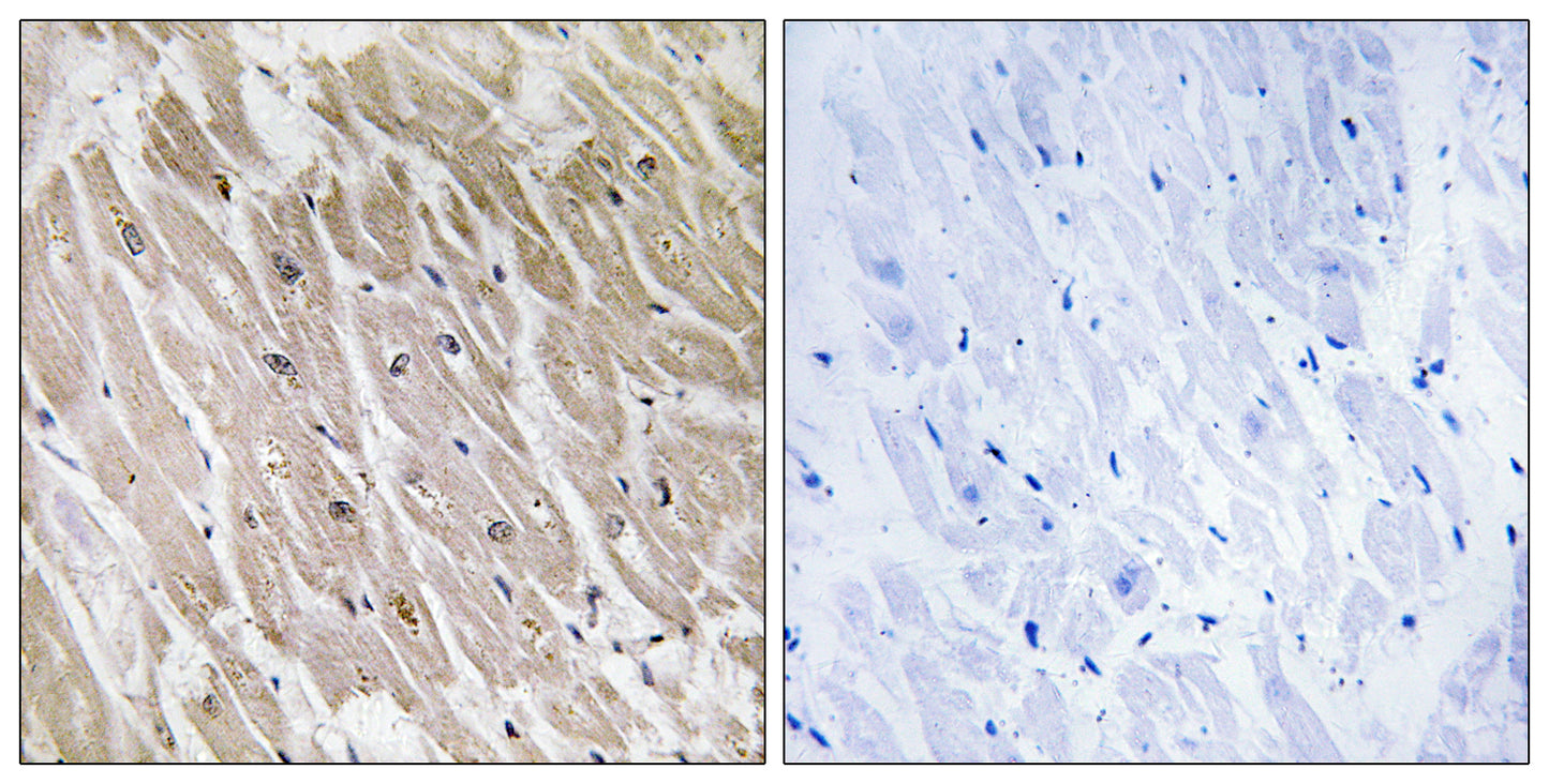 ACAD-10 Rabbit Polyclonal Antibody